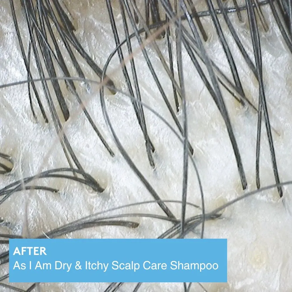 As I Am Dry & Itchy Scalp Care Shampoo & Conditioner β 12 oz - Image 11