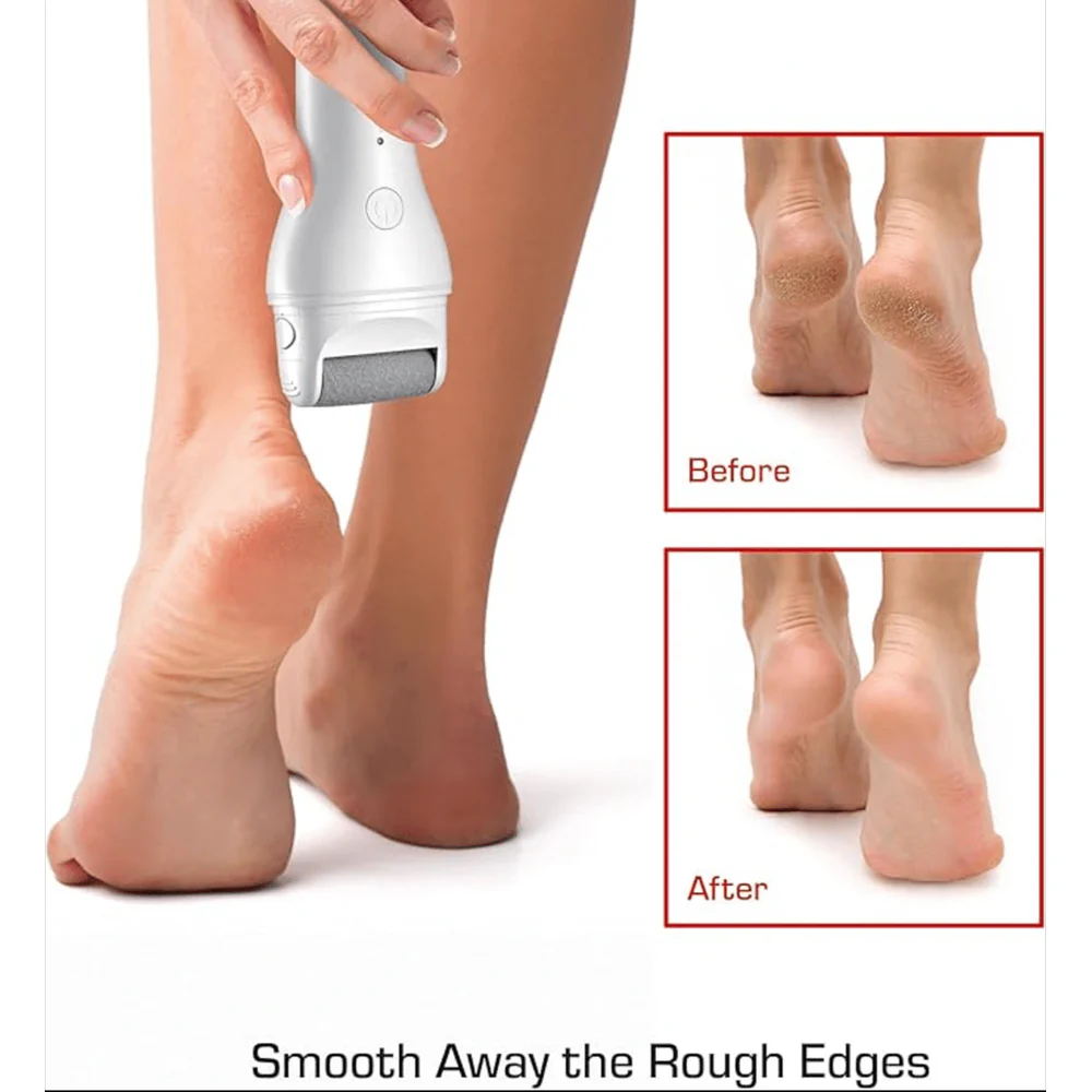Red by Kiss Cordless Foot Callus Remover β 2-Hour Runtime - Image 2