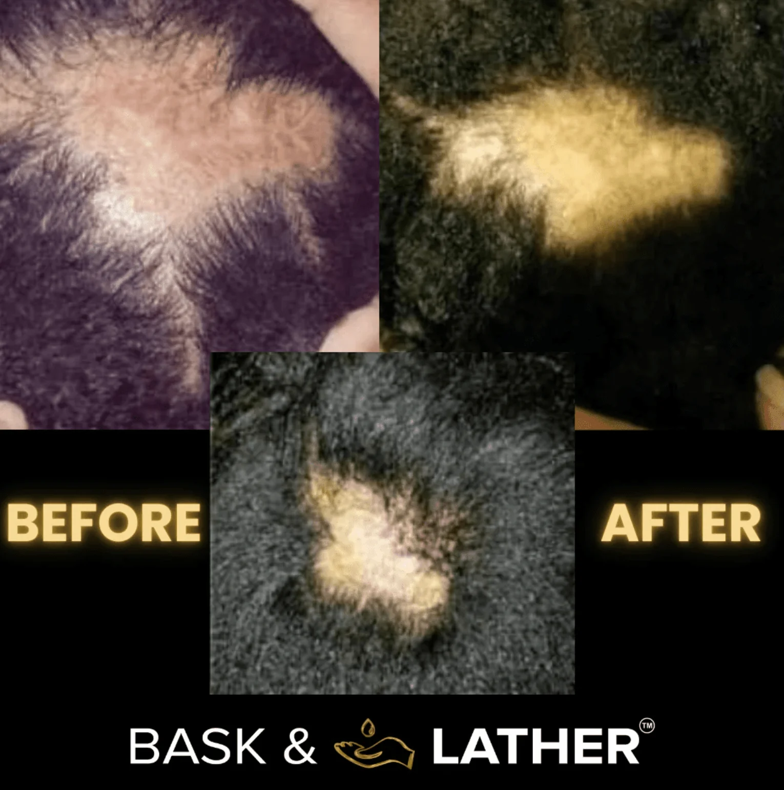Bask & Lather Scalp Stimulator Hair Oil - Image 8