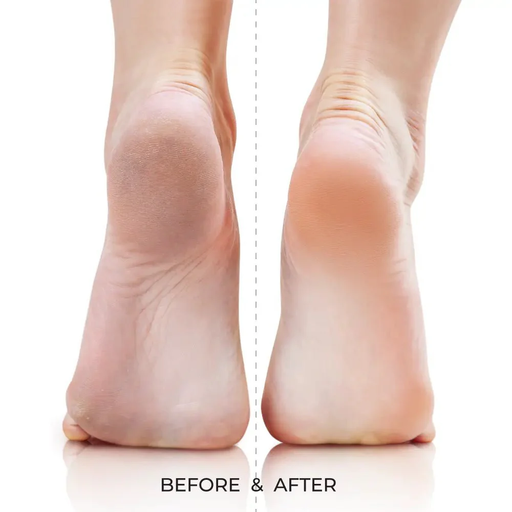 Kiss New York Dual-Sided Foot File – Quickbuff - Image 5