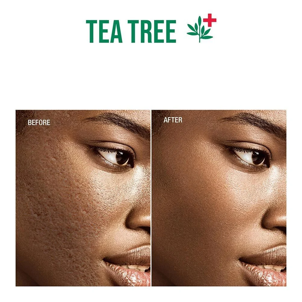Kiss New York Professional – Tea Tree Skincare - Image 9
