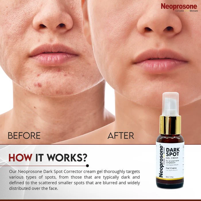 Mitchell Brands Neoprosone Gel Cream - 1oz - Image 5
