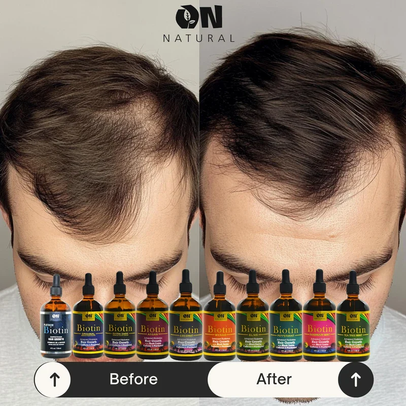 Next Image On Hair Growth Jamaican Black Castor Oil - 4 oz - Image 4
