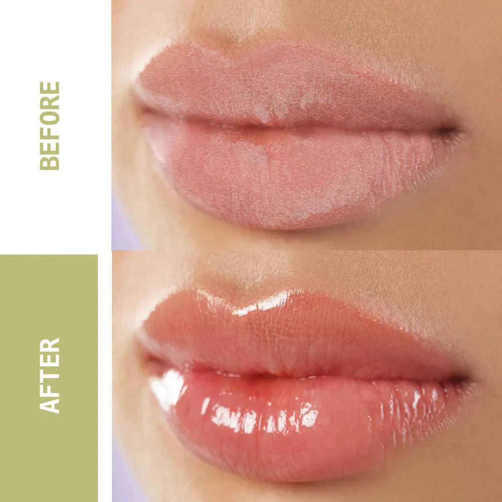 Ruby Kisses Lip Salvation Lip Gloss Menthol-Infused Treatment โ 15ml - Image 4